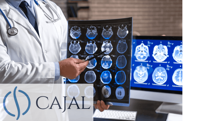 Resonancia Magnética y Tomografía de Cráneo ¿Diferencias?